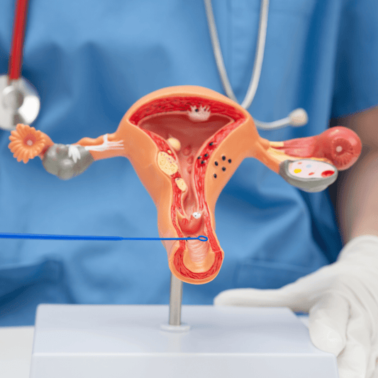 Secchezza vaginale: cause, rimedi naturali e integratori efficaci - Florme Probiotico